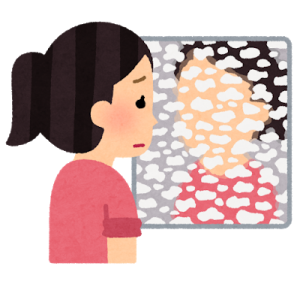 鏡ウロコ　うろこ